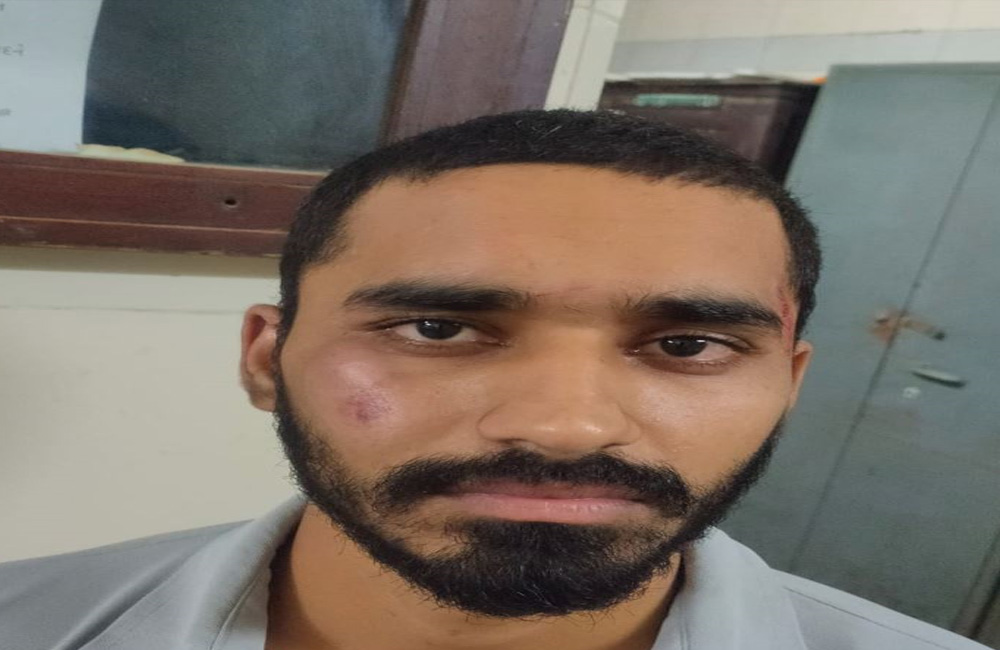 ગુજરાત યુનિવર્સિટીમાં કાશ્મીરનાં વિદ્યાર્થીને બીજા વિદ્યાર્થીઓએ ભેગા થઇને ઢોરમાર માર્યો